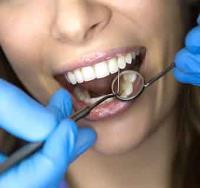 Implant Dentures image 1